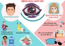 Bài tuyên truyền phòng tránh bệnh đau mắt đỏ